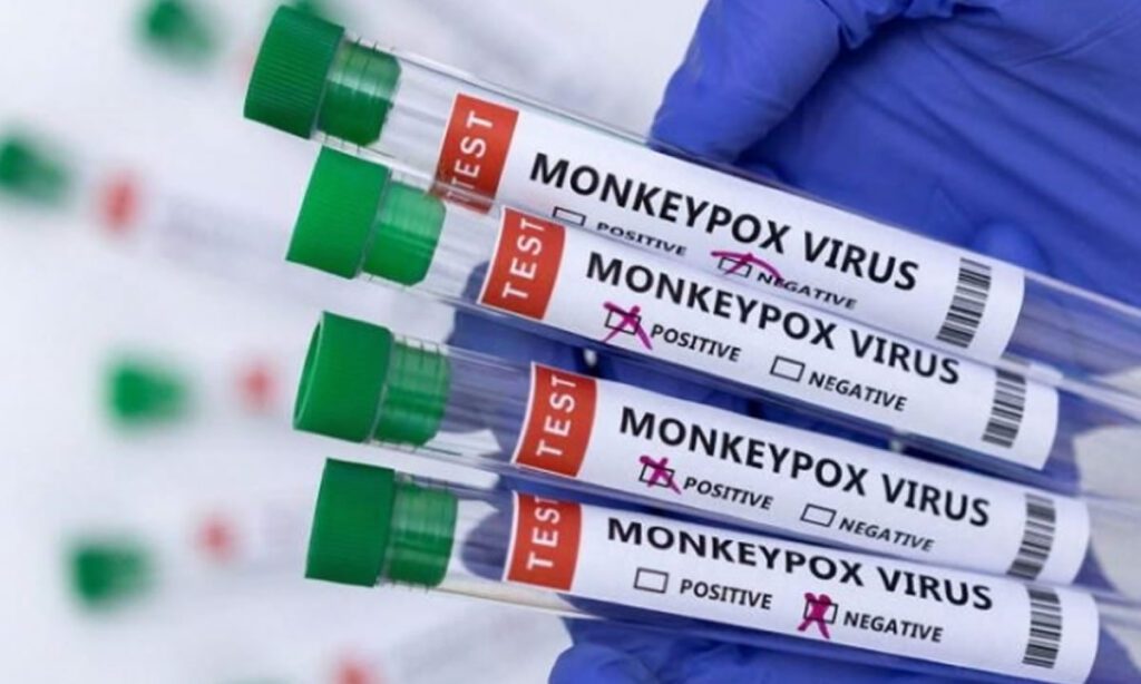 Confirmado o primeiro caso da nova cepa da Mpox no Brasil 2 O primeiro caso da nova cepa da Mpox, conhecida como clado 1b, em território brasileiro, foi confirmado em São Paulo