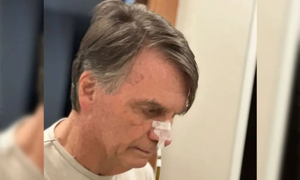 Bolsonaro tem 'piora clínica' e pressão elevada, diz boletim 4 O ex-presidente Bolsonaro passou por cirurgia, no último dia 13, para corrigir complicações no intestino. Ele segue internado na UTI, sem previsão de alta