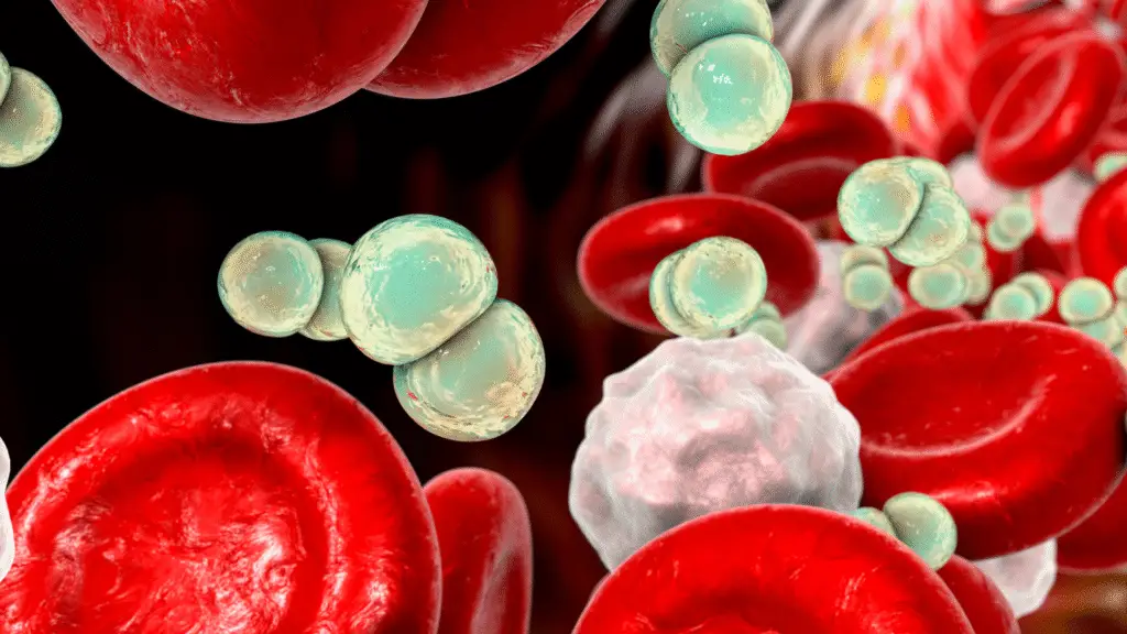 Muito além da meningite: O que é e como age a Meningococcemia 2 Entenda o que é a meningococcemia, uma infecção rara e grave que pode evoluir rapidamente e requer diagnóstico imediato para evitar complicações fatais