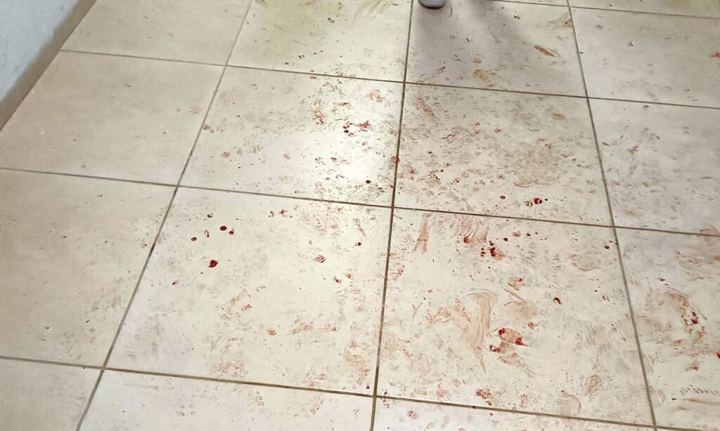 Irmãos agridem brutalmente enfermeiro durante atendimento no hospital de Dionísio Cerqueira 5 edrbd