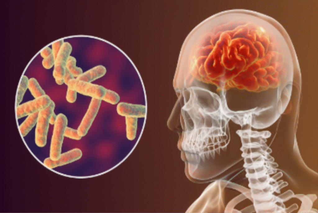 o que e meningite