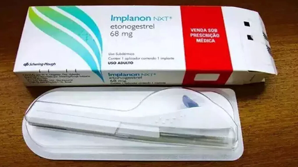 Implante contraceptivo deve ser ofertado por planos de Saúde 2 O Implanon, implante contraceptivo, passa a ser de oferta obrigatória pelos planos de saúde
