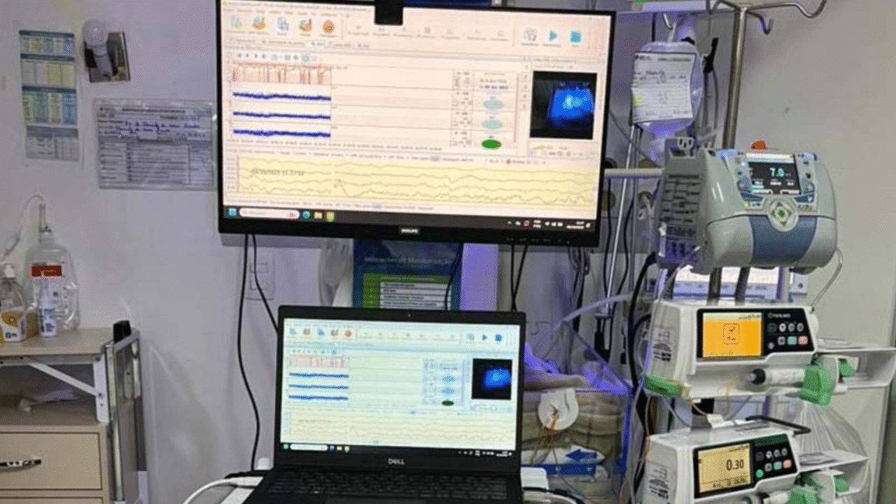 Primeira UTI Neonatal Neurológica do Paraná será inaugurada em Francisco Beltrão 5 Hospital Regional de Francisco Beltrão inaugura primeira UTI Neonatal Neurológica do Paraná, com monitoramento remoto e tecnologia de ponta