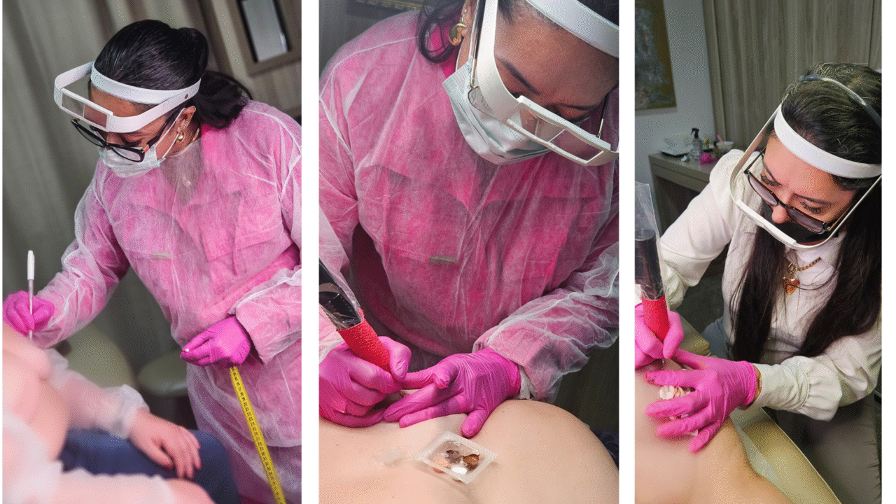 Projeto da Alesc ajuda mulheres mastectomizadas a recuperarem a autoestima 3 Alesc promove ação do Outubro Rosa com reconstrução gratuita de aréolas para mulheres mastectomizadas em parceria com o Projeto Traços do Bem.
