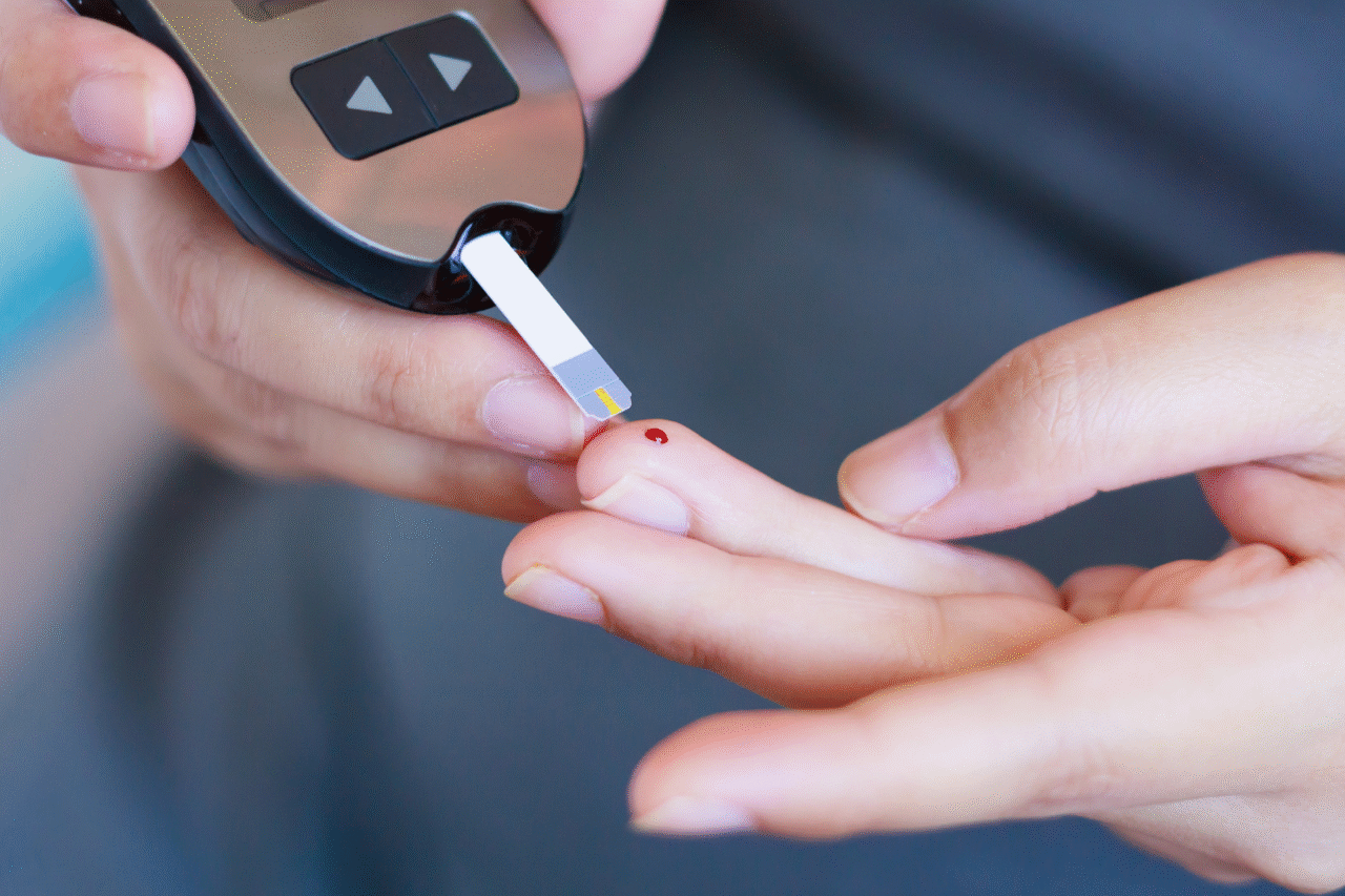 Santa Catarina analisa projeto que prevê monitoramento digital contínuo da glicemia pelo SUS para crianças e adolescentes 3 Proposta prevê monitoramento contínuo da glicemia para jovens com diabetes, com fornecimento de sensores e aparelhos digitais às famílias atendidas pelo SUS.