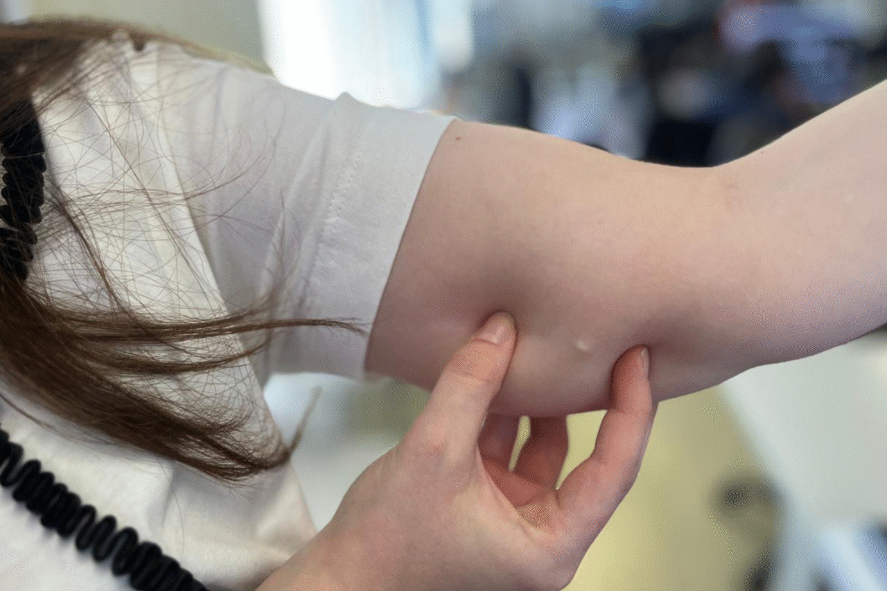 Implante contraceptivo de até R$ 4 mil começa a ser distribuído gratuitamente pelo SUS no Paraná; medida amplia acesso a método de longa duração para adolescentes e mulheres em todo o Estado.