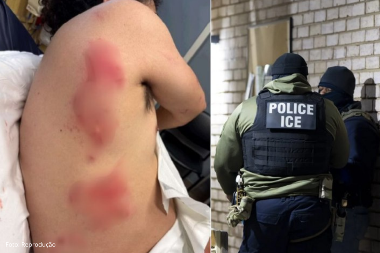 Senadora denuncia uso de cão para atacar imigrante durante ação do ICE nos EUA