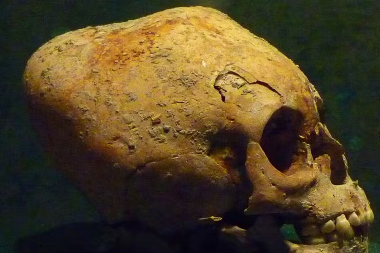 Descoberta no México revela raro crânio quadrado moldado por deformação intencional há mais de 1.500 anos