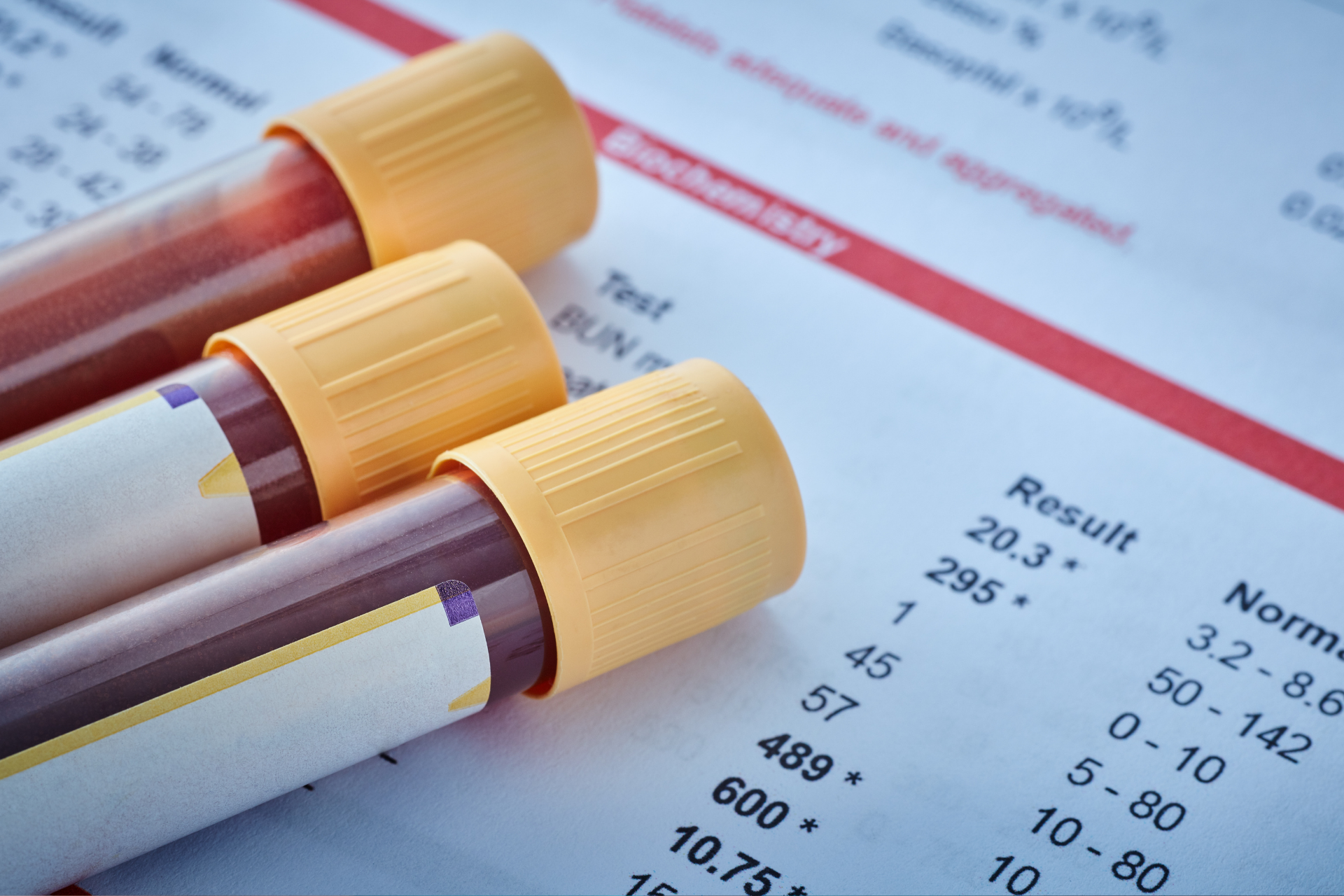 Mais de 70% dos brasileiros ignoram o check-up médico e colocam a própria saúde em risco, alerta especialista