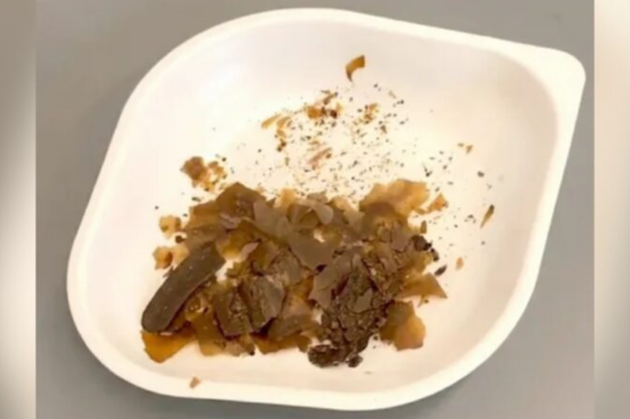 Análises químicas revelam que romanos usavam fezes humanas como medicamento há quase 2 mil anos 38 Análises químicas revelam que romanos usavam fezes humanas como medicamento há quase 2 mil anos