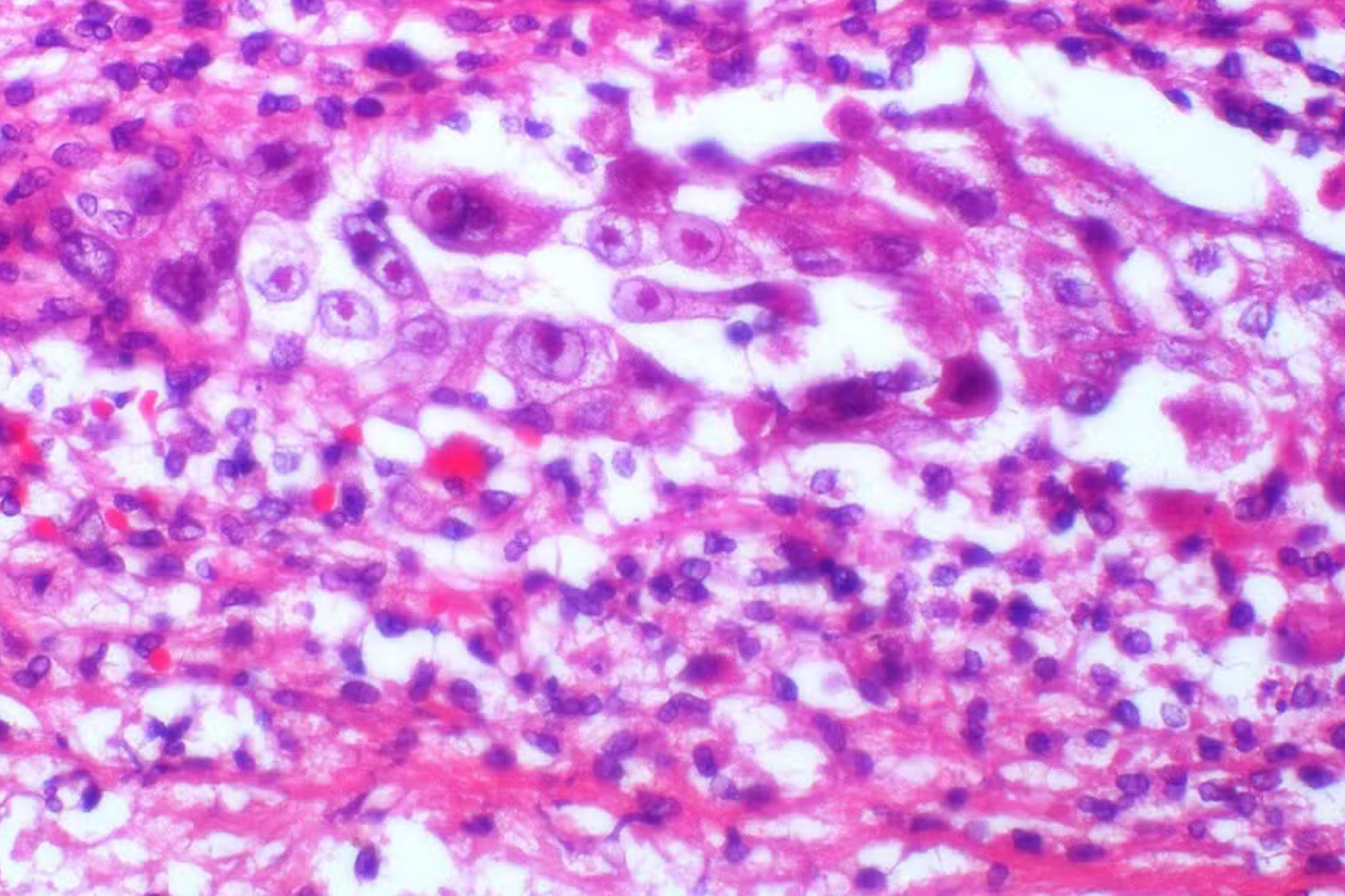 Herpes humano circula há pelo menos 2,5 mil anos, aponta pesquisa com DNA antigo 3 Herpes humano circula há pelo menos 2,5 mil anos, aponta pesquisa com DNA antigo