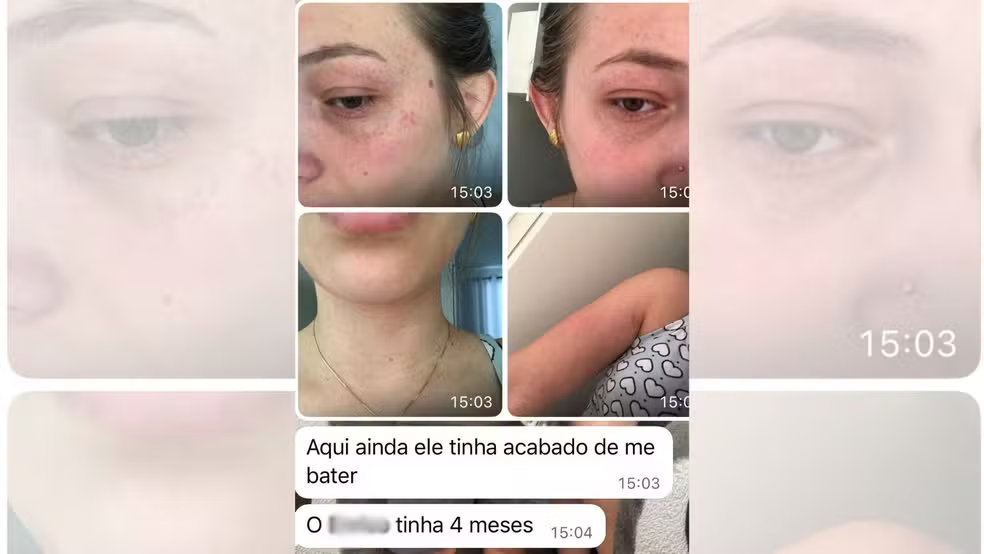 Mulher com 11 boletins de ocorrência contra o ex-marido morre após ser baleada 3 Mulher havia registrado ao menos 11 BOs contra o ex-companheiro, e teve inclusive medidas protetivas de urgência negadas pela justiça