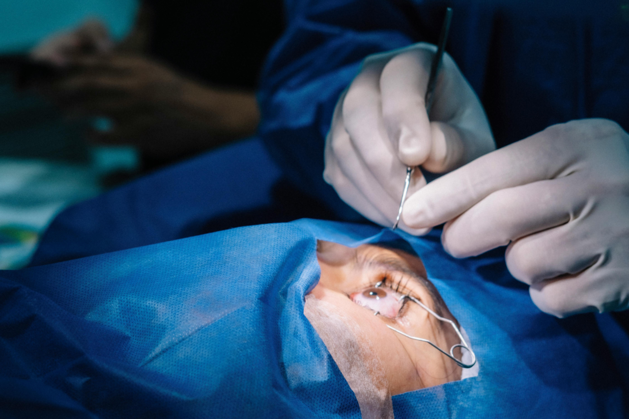 Onze pacientes perdem visão após cirurgias de catarata 3 Após procedimentos de catarata em clínica particular de Salvador, 11 pacientes passaram por evisceração ocular; unidade foi interditada e caso está sob investigação.