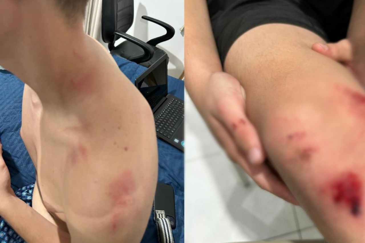 Adolescente é agredido por homem com máscara de palhaço em Itajaí 3 Adolescente é agredido por homem com máscara de palhaço em Itajaí