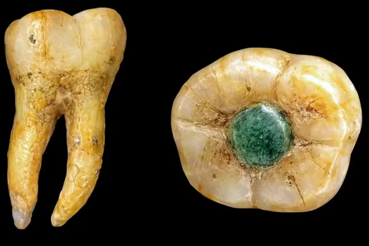 Dente maia com pedra preciosa intriga cientistas 1 Dente maia com pedra preciosa intriga cientistas