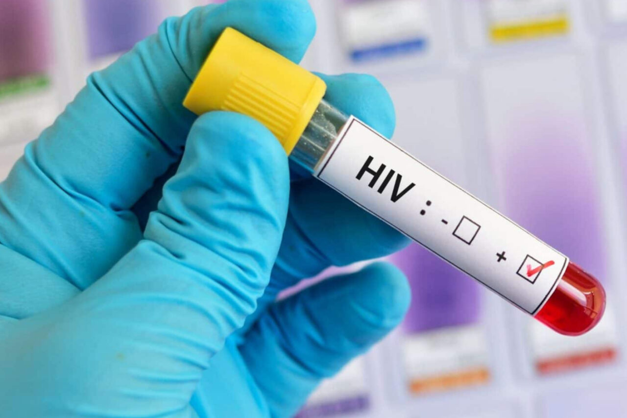 Morre paciente de 64 anos que recebeu transplante de órgão com HIV 4 A paciente era uma mulher de 64 anos e estava em acompanhamento médico desde a confirmação da infecção