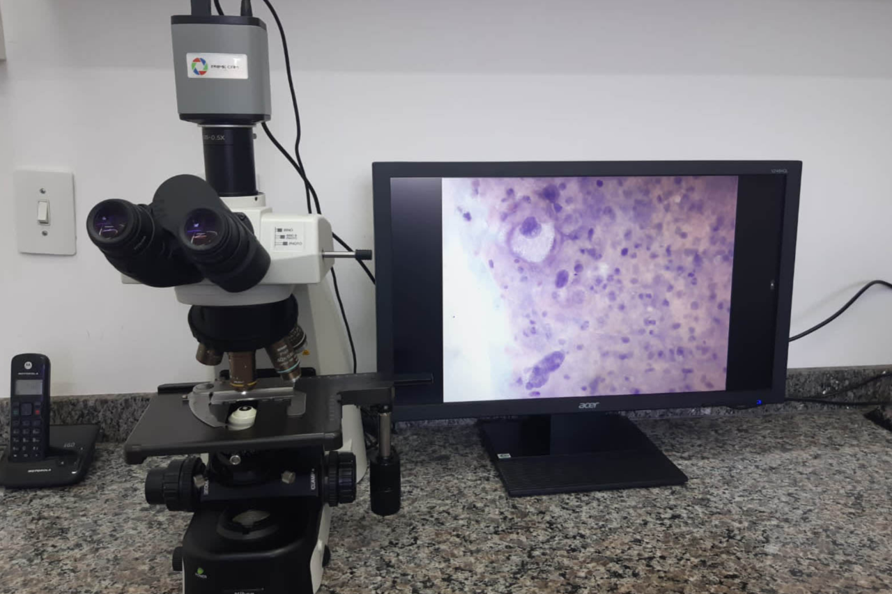 Paraná amplia exame de DNA-HPV para todos os municípios e reforça combate ao câncer de colo do útero 3 Paraná amplia exame de DNA-HPV para todos os municípios e reforça combate ao câncer de colo do útero
