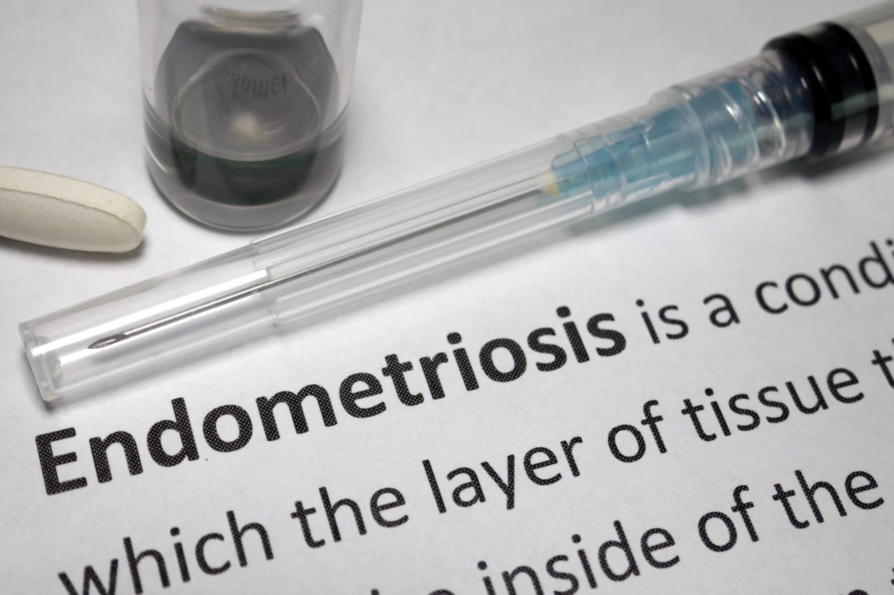Estudo genético amplia compreensão sobre endometriose e aponta relação com enxaqueca, ansiedade e depressão 3 Estudo genético amplia compreensão sobre endometriose e aponta relação com enxaqueca, ansiedade e depressão