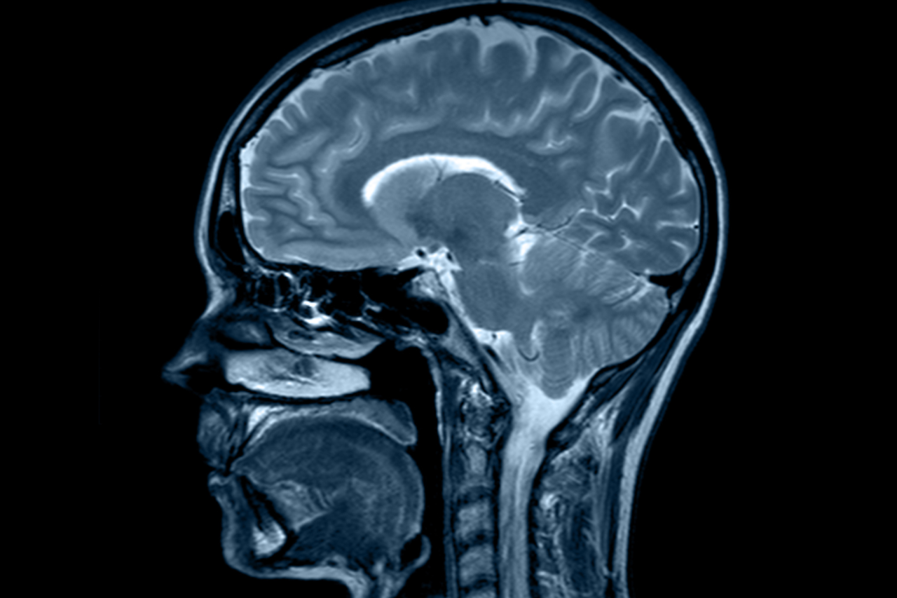 Pesquisa publicada na revista Cell identifica como a proteína Arc pode favorecer o transporte da tau entre neurônios e abrir caminho para novas estratégias contra a progressão do Alzheimer