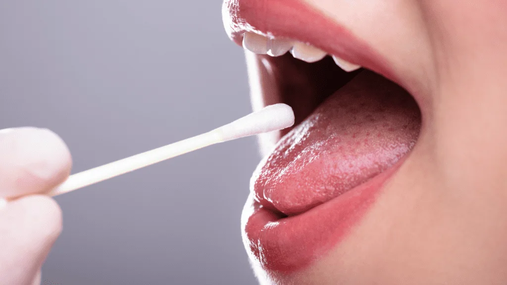 Endometriose pode ser diagnosticada através da saliva? 1 crys 27 2