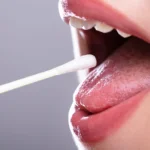 Endometriose pode ser diagnosticada através da saliva?