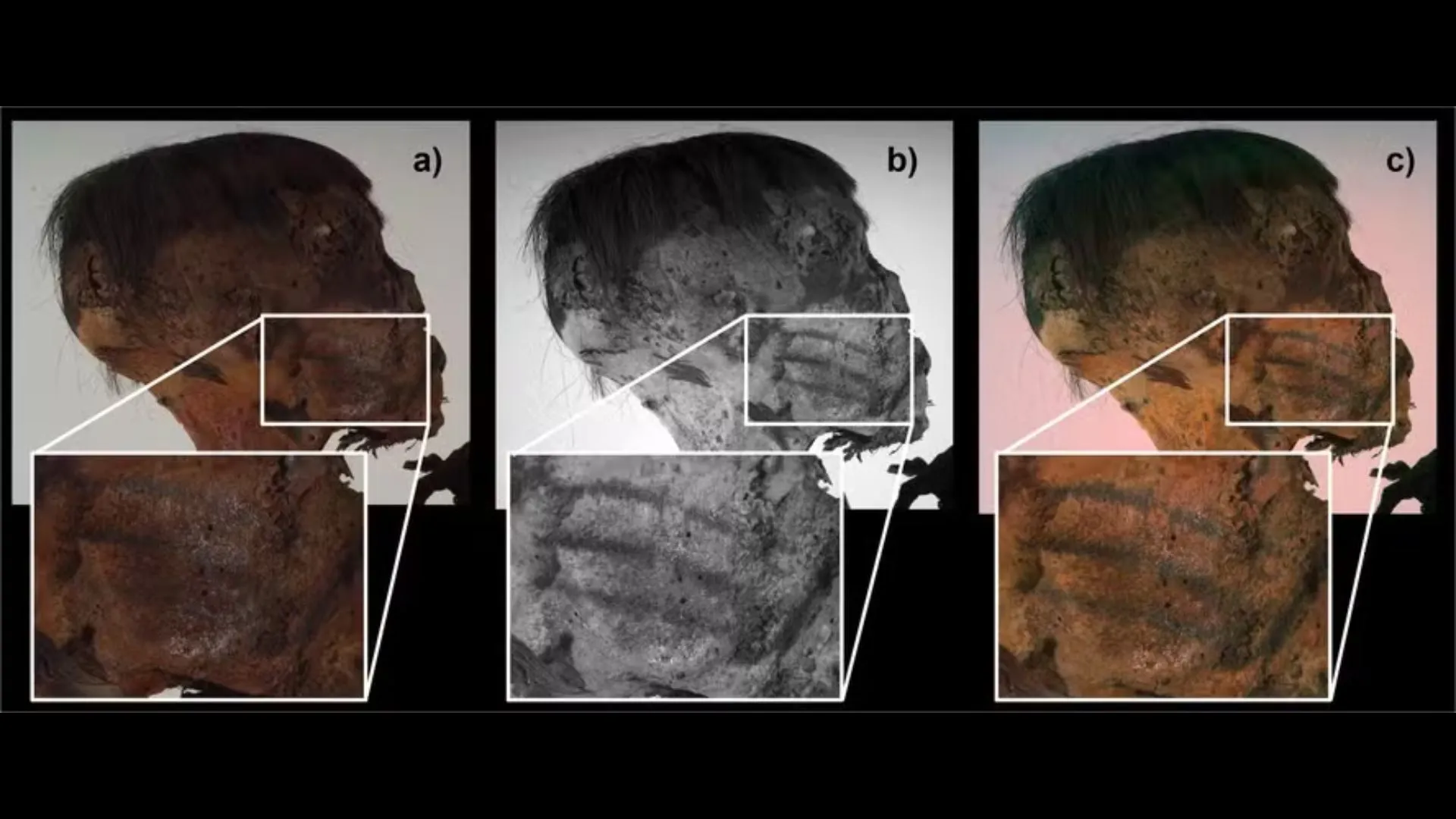 Múmia andina revela tatuagens secretas no rosto após 800 anos