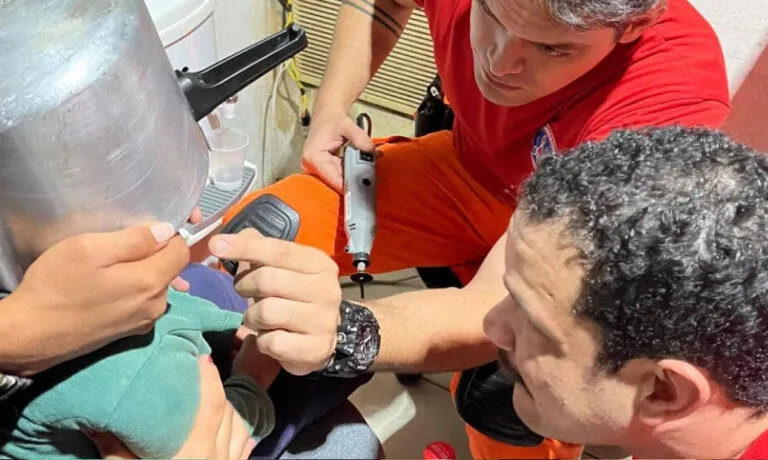 Menino de 2 anos passa mais de uma hora com panela de pressão presa na cabeça