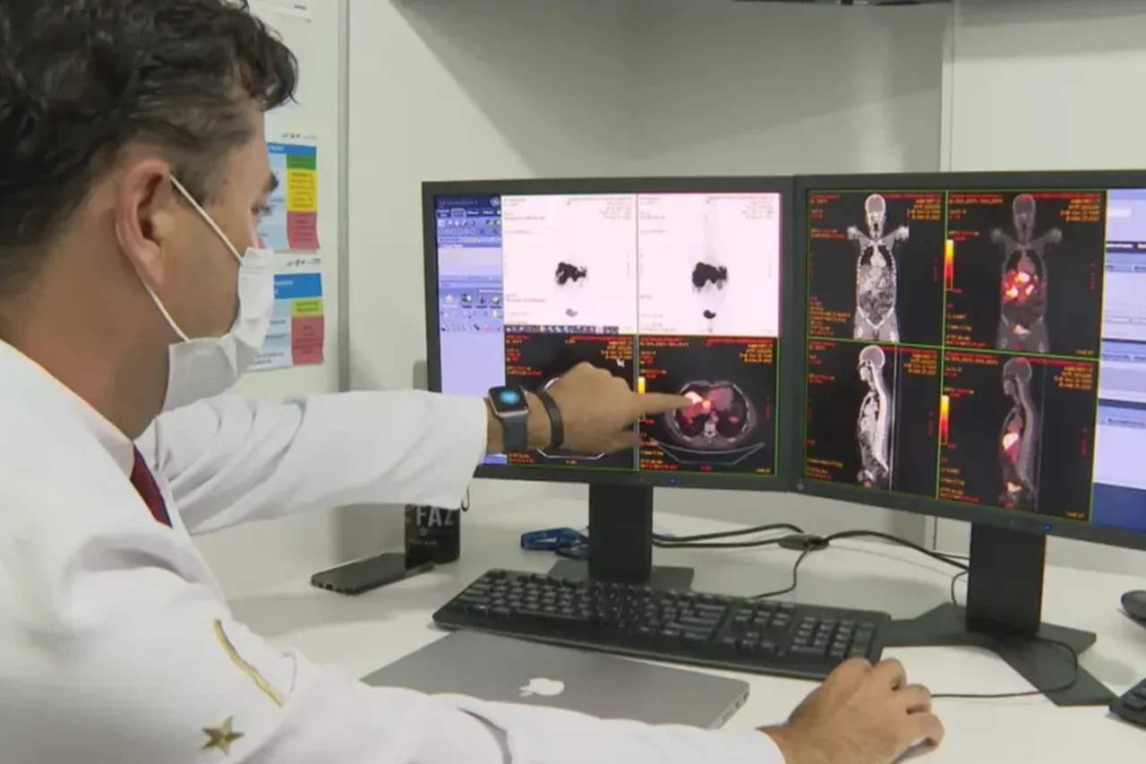 Doença rara e silenciosa dificulta diagnóstico e exige tratamento especializado 3 Pseudomixoma peritoneal é uma doença rara, de evolução lenta e sintomas discretos, que costuma ser diagnosticada tardiamente e requer tratamento em centros especializados.