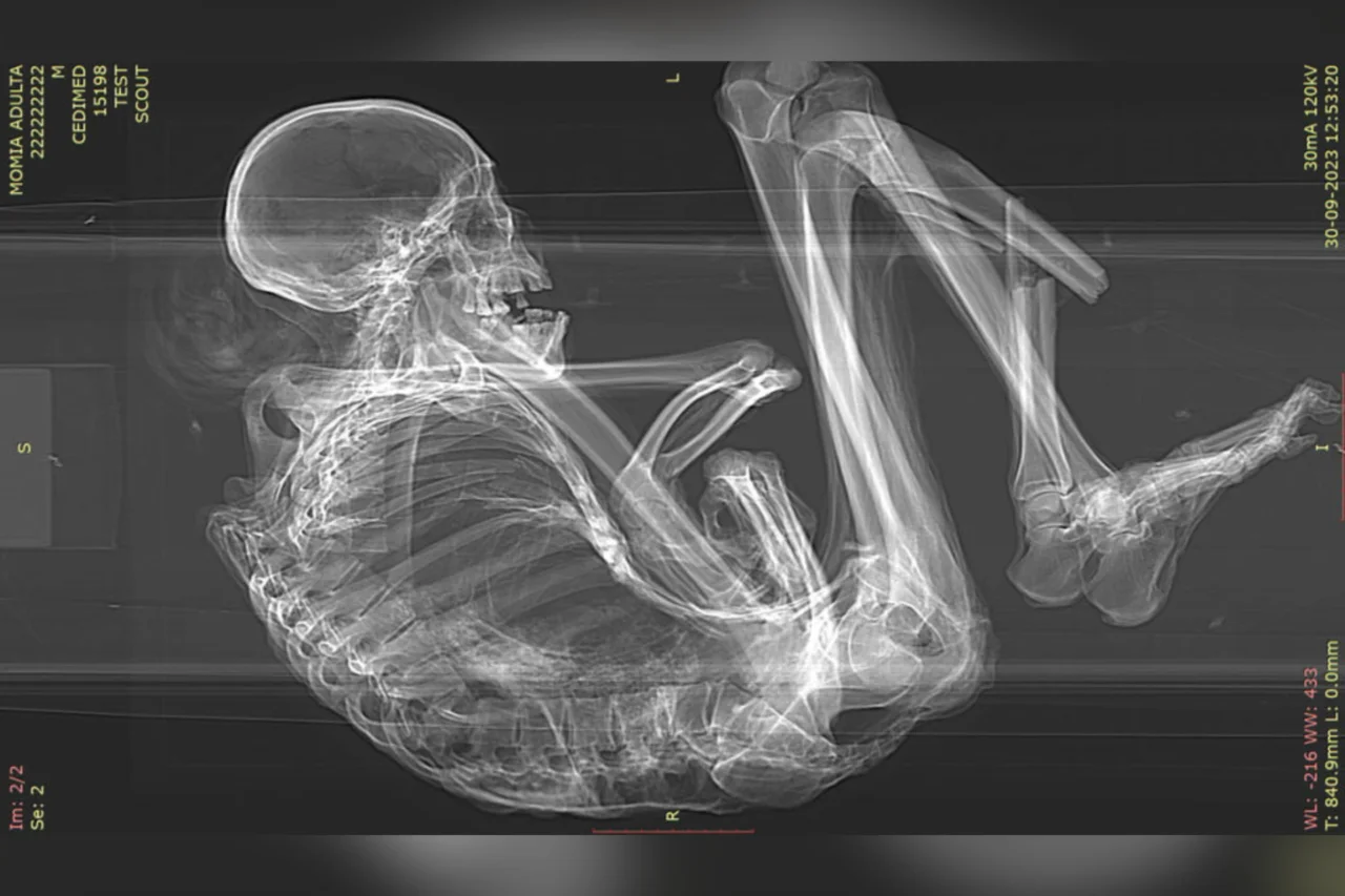 Estudo revela detalhes da morte de múmia de 1.100 anos encontrada no Deserto do Atacama 1 Estudo revela detalhes da morte de múmia de 1.100 anos encontrada no Deserto do Atacama