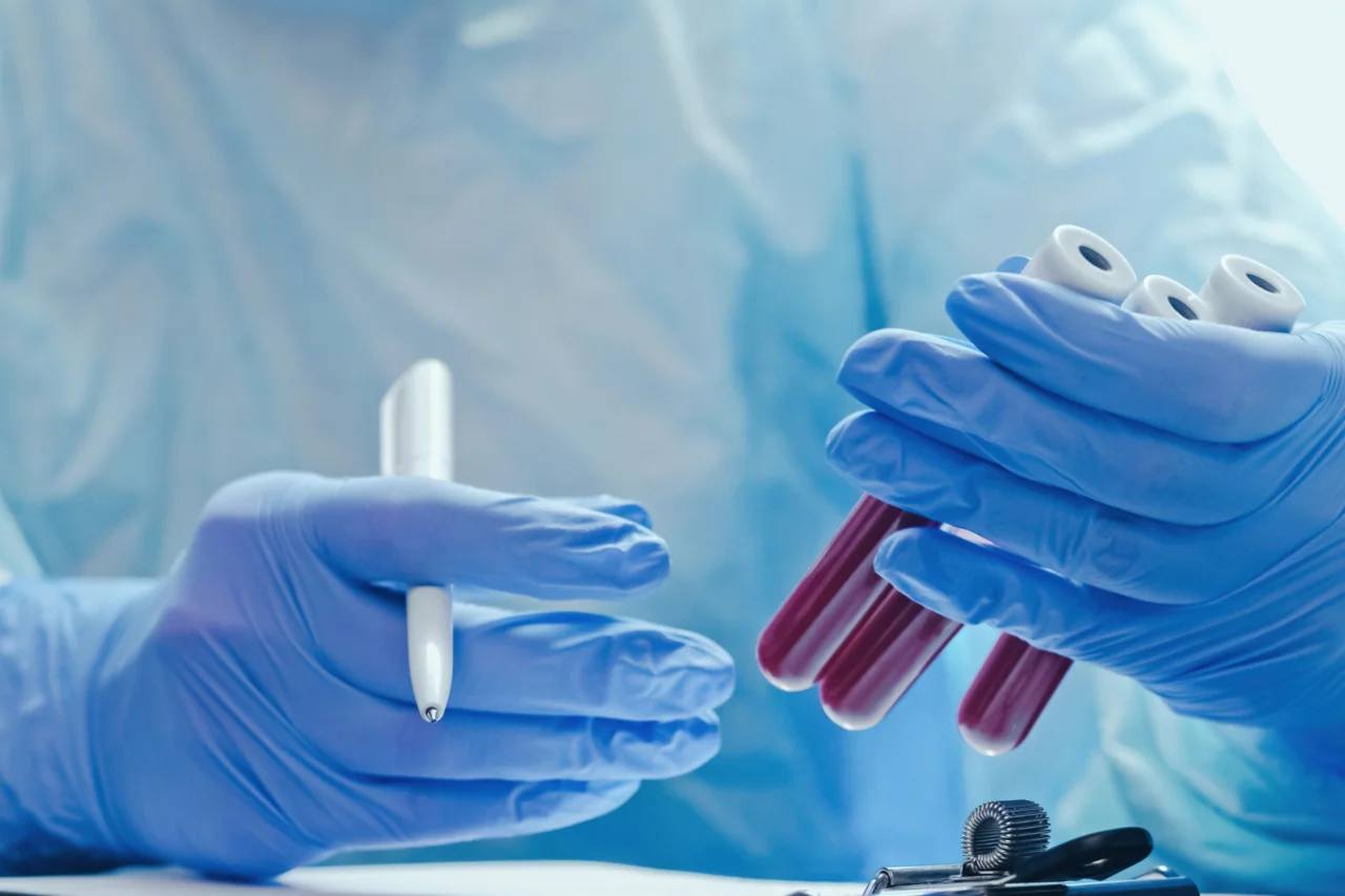 Pesquisa aponta exame de sangue capaz de indicar Parkinson até 20 anos antes dos sintomas 3 crys 11