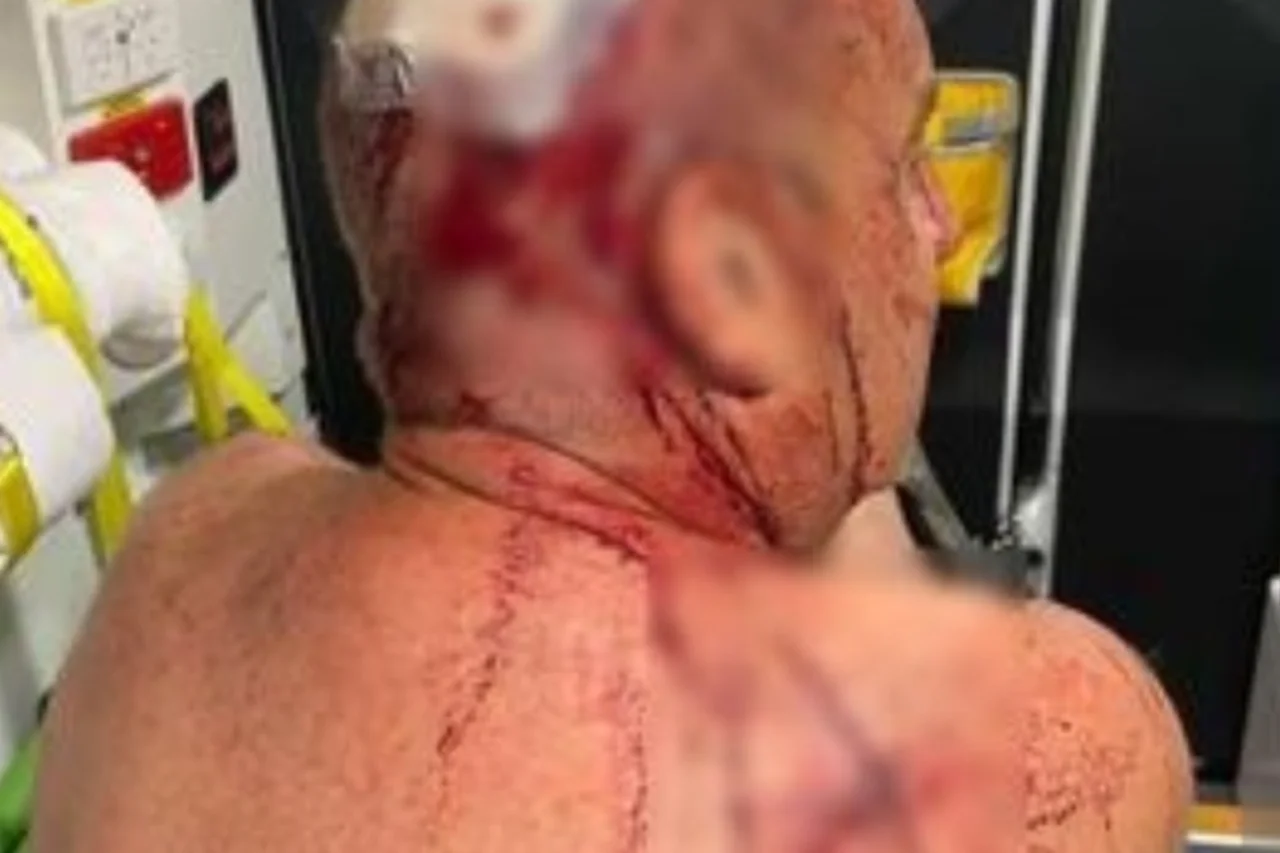 Aposentado foi hospitalizado após ser atacado por canguru ao tentar defender um cachorro. Caso ocorreu na Austrália e foi relatado à imprensa local.