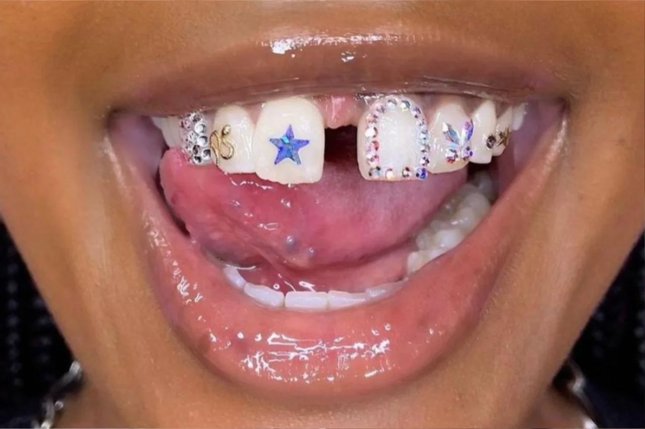 Joias nos dentes viram febre nos consultórios e prometem transformar o sorriso em acessório de moda 26 Heloisa L 5