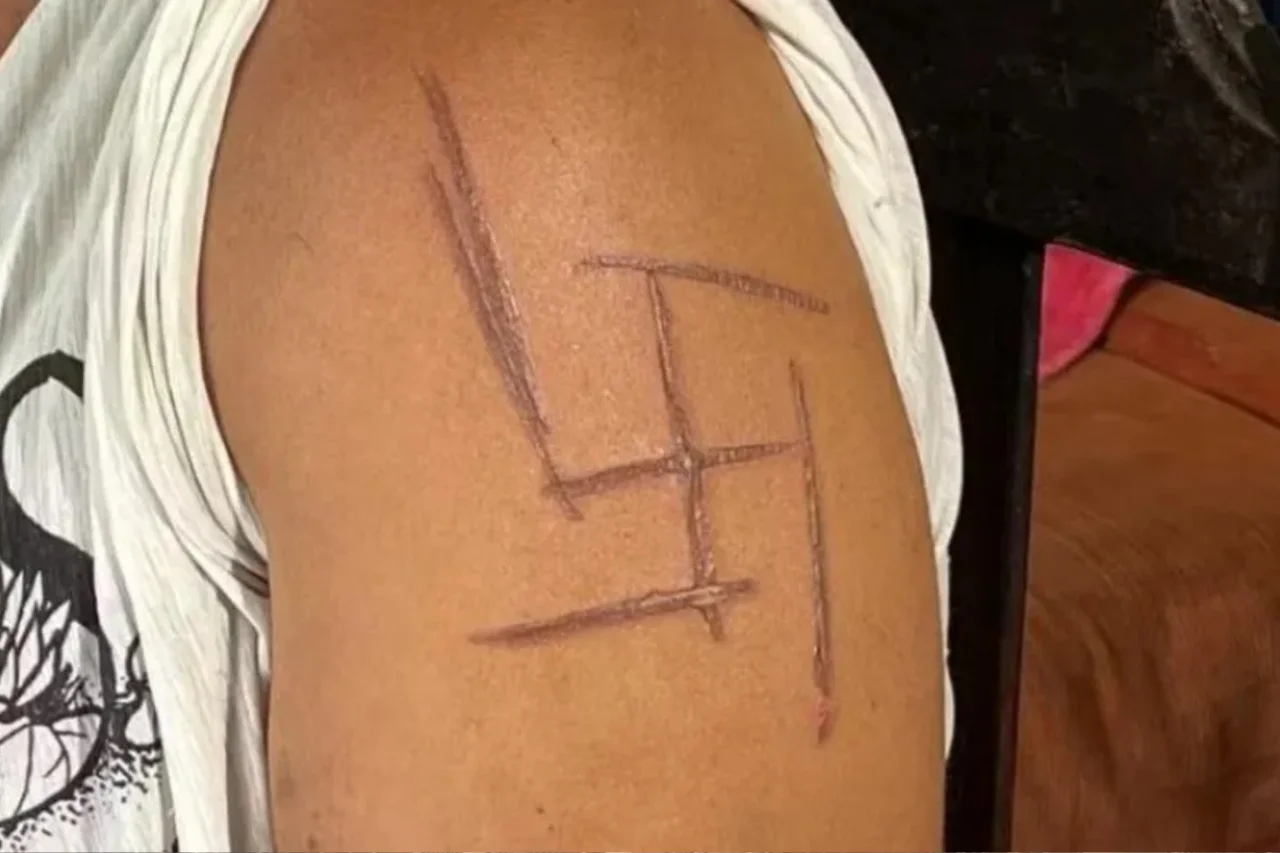 Mulher denuncia tortura e agressões em Ponta Porã; namorado e patrões têm prisão preventiva decretada 13 Mulher denuncia tortura e agressões em Ponta Porã; namora e patrões têm prisão preventiva decretada