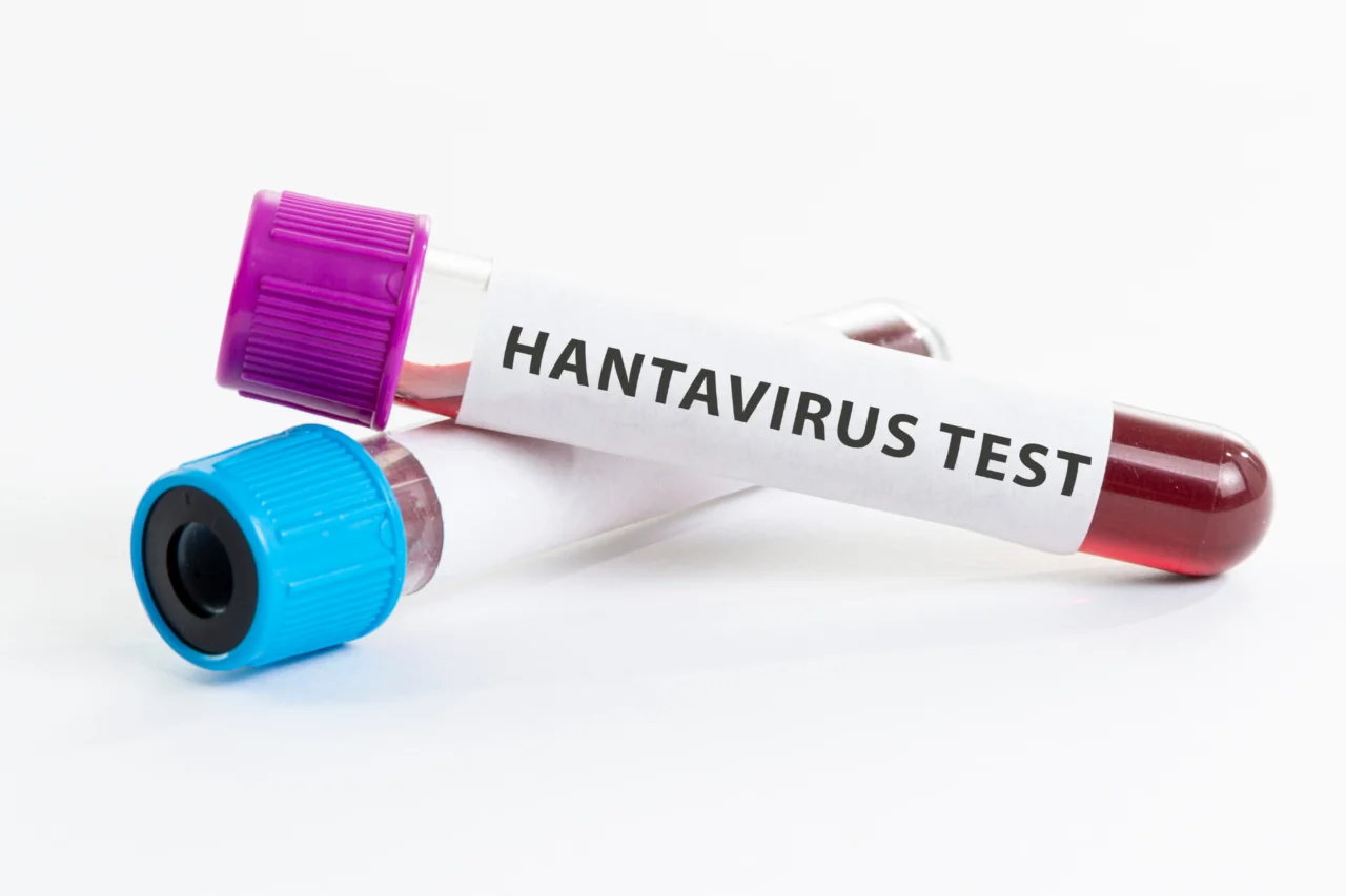 Paraná registra dois casos de hantavírus e 11 em investigação; um dos pacientes é de Pérola d'Oeste